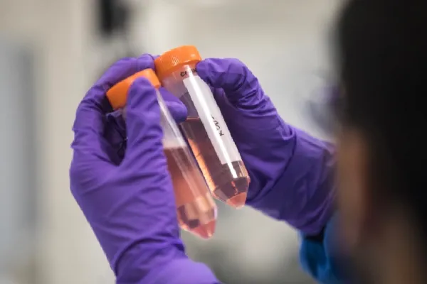 Simon Dawson/Bloomberg