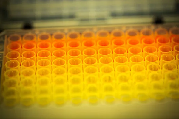 (Carsten Snejbjerg/Bloomberg)